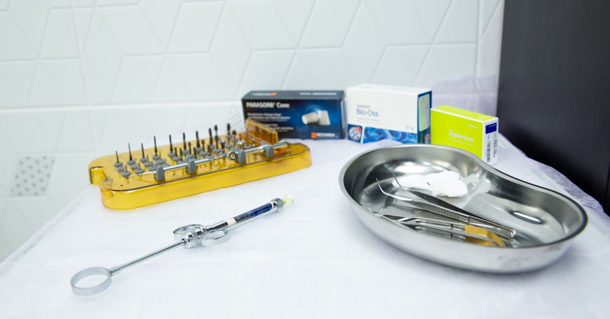 Comparing In-Office and At-Home Teeth Whitening Solutions